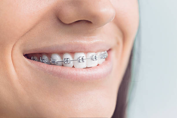 Trusted La Habra Heights, CA  Holistic Dental Services Experts